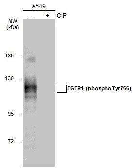 FGFR1 (phospho Tyr766) antibody