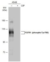FGFR1 (phospho Tyr766) antibody