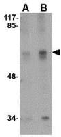STK39 antibody