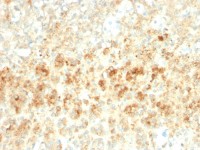 ADFP antibody [ADFP/2755R]
