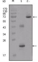 IGFBP2 antibody [1F6F6]