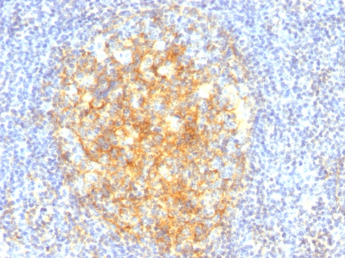 VCAM1 / CD106 antibody [VCAM1/843]