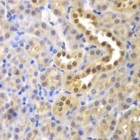 Glyoxalase I antibody