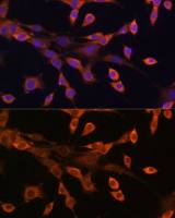 PKA I alpha reg antibody