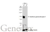 Interferon gamma Receptor 1 antibody