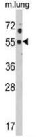Kir2.1 antibody, C-term