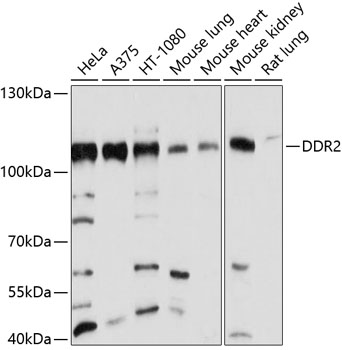 DDR2 antibody