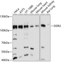 DDR2 antibody