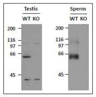 SLC22A14 antibody