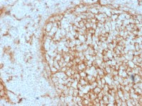 CD14 antibody [LPSR/2397]