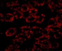 NPC1 antibody