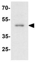 APOBEC3B antibody