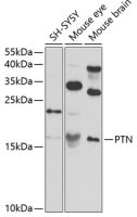 Pleiotrophin antibody