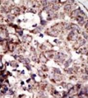 RAGE antibody, N-term