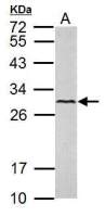VEGFC antibody