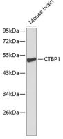 CtBP1 antibody