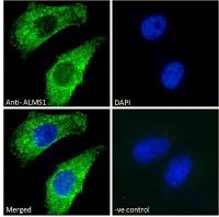 ALMS1 antibody