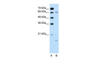 CYP4A22 antibody, N-term