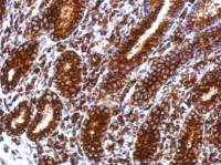 CD74 antibody