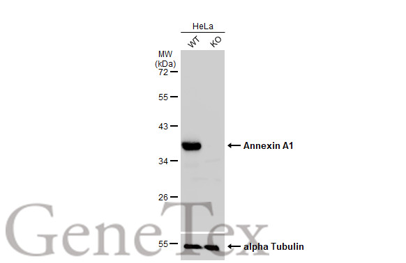 Annexin A1 antibody