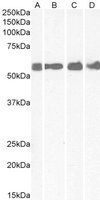 CRHR1 (aa 107 - 117) antibody, Internal