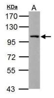 Thbs4b antibody