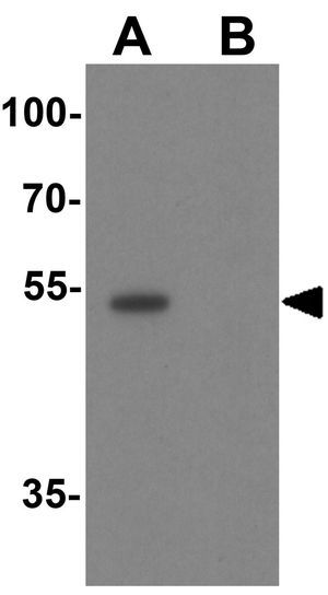 SESN2 antibody