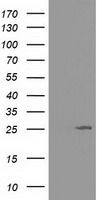 AK3 antibody [6D6]