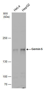 Gemin 5 antibody