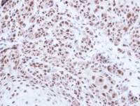 PRPF39 antibody [N2C1], Internal