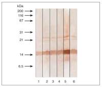 Calcitonin antibody [16B5]