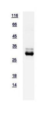 Human CSEN protein, His tag