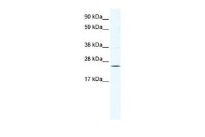KCTD6 antibody, N-term