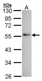 Annexin XI antibody
