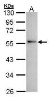 Annexin XI antibody