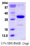 Human p21 Cip1 protein, His tag