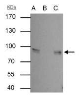 gamma Catenin antibody [C2C3], C-term