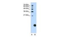 RPS29 antibody, N-term