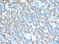 GluT1 antibody