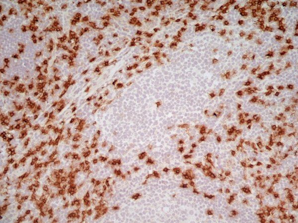 CD8 antibody [LT8]