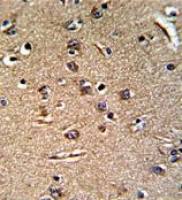 GGT5 antibody, N-term