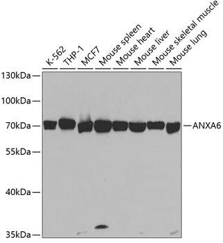 Annexin VI antibody