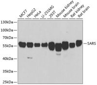 Seryl-tRNA synthetase antibody