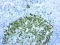 Blue Hematoxylin Kit