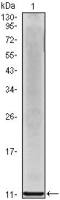 CXCL8 / IL8 antibody [3E4D8]