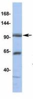 TPCN1 antibody, N-term