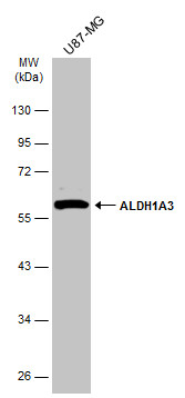ALDH1A3 antibody [N2C2], Internal
