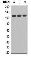 Enterokinase Light chain antibody