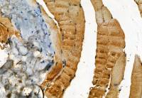 MLKL (phospho Ser358) antibody