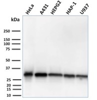 MTAP antibody [MTAP/3137R]